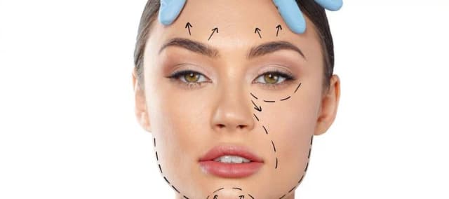 Brow Lift or Forehead Lift Surgery